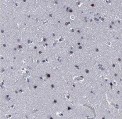 Immunohistochemistry-Paraffin: BRD1 Antibody [NBP1-88351]