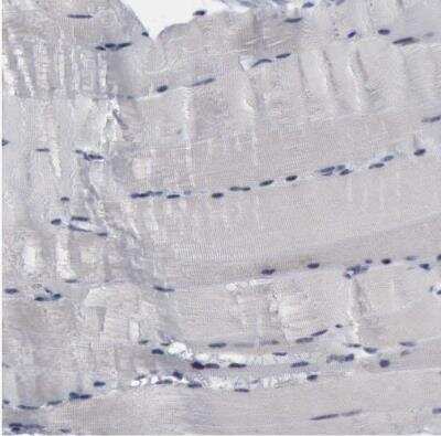 Immunohistochemistry-Paraffin: BRD1 Antibody [NBP1-88351]