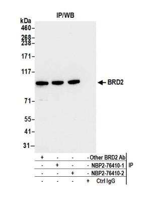 Immunoprecipitation: BRD2 Antibody (BL-167-2A2) [NBP2-76410]