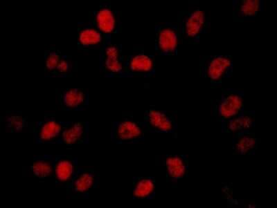 Immunocytochemistry/ Immunofluorescence: BRD2 Antibody [NBP1-30474]