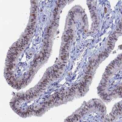 Immunohistochemistry-Paraffin: BRD2 Antibody [NBP1-84310]