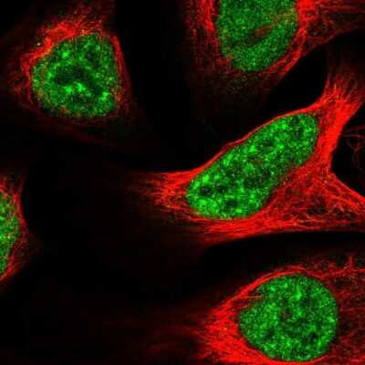Immunocytochemistry/ Immunofluorescence: BRD2 Antibody [NBP1-84310]