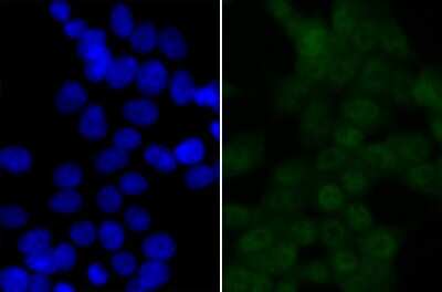 Immunocytochemistry/ Immunofluorescence: BRD2 Antibody (JG40-42) [NBP2-75422]