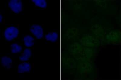 Immunocytochemistry/ Immunofluorescence: BRD2 Antibody (JG40-42) [NBP2-75422]