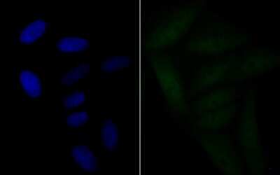 Immunocytochemistry/ Immunofluorescence: BRD2 Antibody (JG40-42) [NBP2-75422]