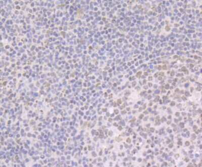 Immunohistochemistry-Paraffin: BRD2 Antibody (JG40-42) [NBP2-75422]