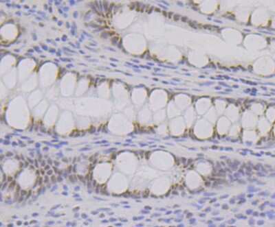 Immunohistochemistry-Paraffin: BRD2 Antibody (JG40-42) [NBP2-75422]