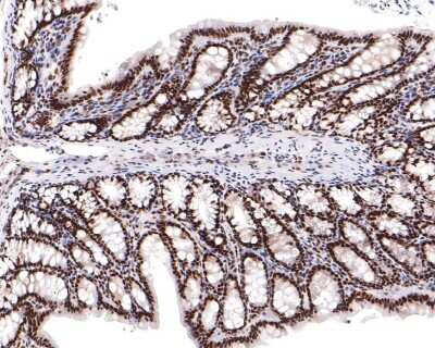 Immunohistochemistry-Paraffin: BRD2 Antibody (JG40-42) [NBP2-75422]