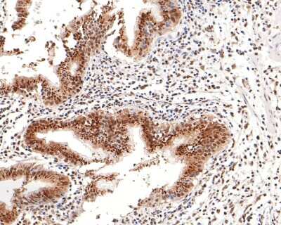 Immunohistochemistry-Paraffin: BRD2 Antibody (JG40-42) [NBP2-75422]
