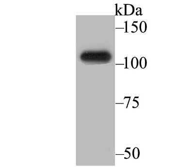 Western Blot: BRD2 Antibody (JG40-42) [NBP2-75422]