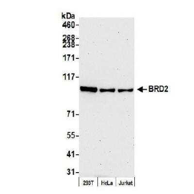 Western Blot: BRD2 Antibody [NBP1-30475]
