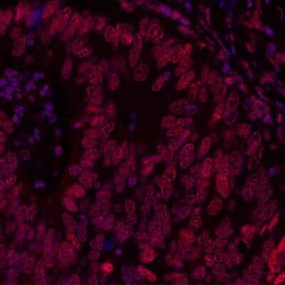Immunohistochemistry: BRD3 Antibody (BLR069G) [NBP2-77359]