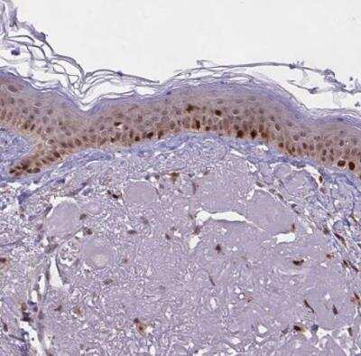 Immunohistochemistry-Paraffin: BRD3 Antibody [NBP2-14360]