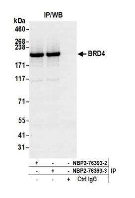 Immunoprecipitation: BRD4 Antibody (BL-149-2H5) [NBP2-76393]