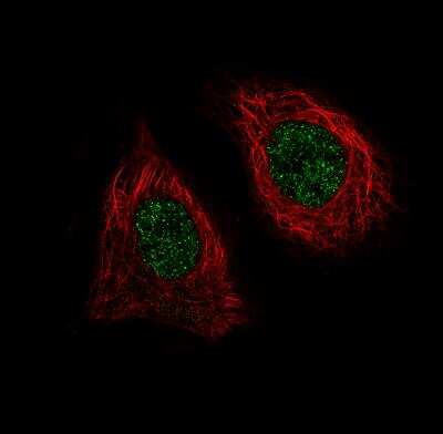 Immunocytochemistry/ Immunofluorescence: BRD4 Antibody (CL1115) [NBP2-52958]