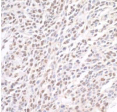 Immunohistochemistry-Paraffin: BRD4 Antibody [NBP1-18874]
