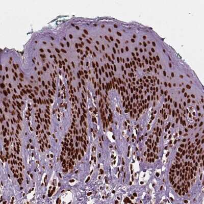 Immunohistochemistry-Paraffin: BRD4 Antibody [NBP2-38931]