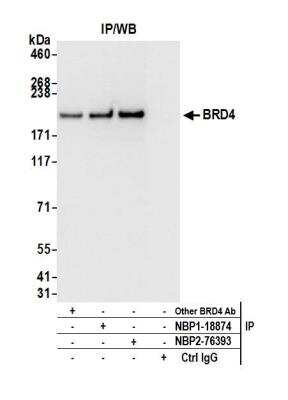 Immunoprecipitation: BRD4 Antibody [NBP1-18874]
