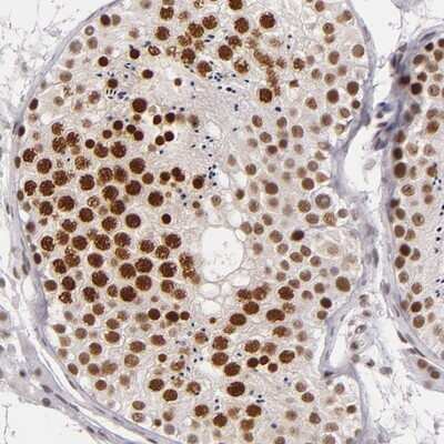 Immunohistochemistry-Paraffin: BRD8 Antibody [NBP1-82457]