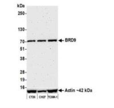 Western Blot: BRD9 Antibody (BLR153J) [NBP3-14730]