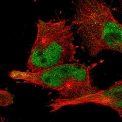 Immunocytochemistry/ Immunofluorescence: BRD9 Antibody [NBP1-82256]