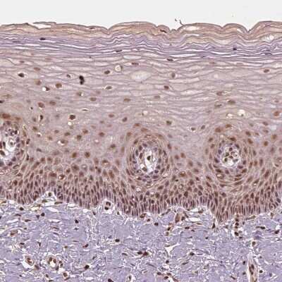 Immunohistochemistry-Paraffin: BRD9 Antibody [NBP2-58517]