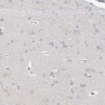 Immunohistochemistry-Paraffin: BRDG1/STAP-1 Antibody [NBP1-89941]