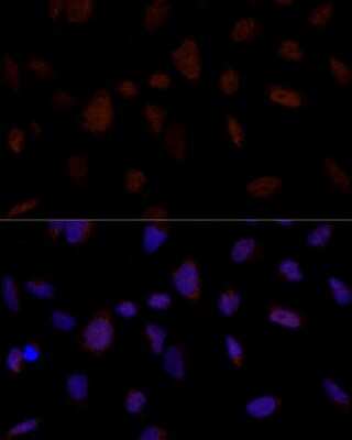 Immunocytochemistry/ Immunofluorescence: BRE Antibody - Azide and BSA Free [NBP2-92866]