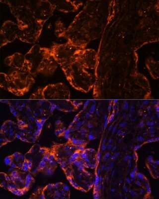 Immunohistochemistry: BRE Antibody - Azide and BSA Free [NBP2-92866]