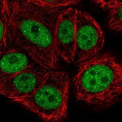 Immunocytochemistry/ Immunofluorescence: BRF1 Antibody [NBP2-55335]