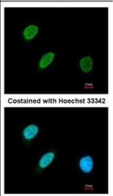 Immunocytochemistry/ Immunofluorescence: BRF2 Antibody [NBP2-15617]