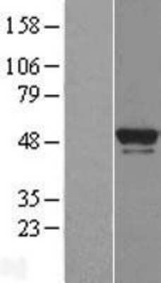 Western Blot: BRF2 Overexpression Lysate [NBL1-08027]