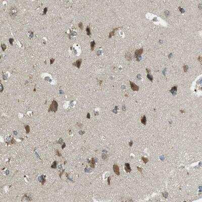 Immunohistochemistry-Paraffin: BRI3BP Antibody [NBP1-88564]