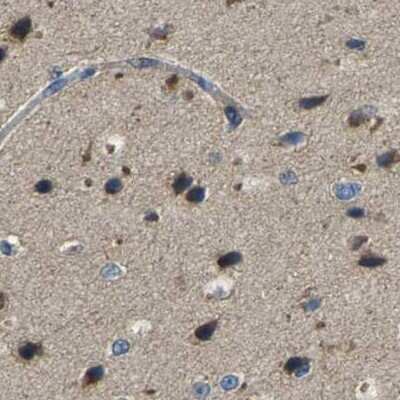Immunohistochemistry-Paraffin: BRIC Antibody [NBP1-90067]
