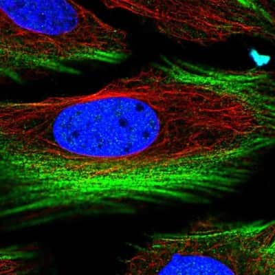 Immunocytochemistry/ Immunofluorescence: BRICD5 Antibody [NBP2-56405]