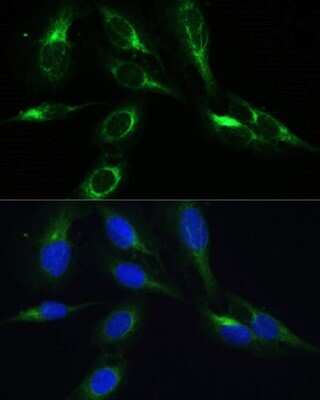 Immunocytochemistry/ Immunofluorescence: BRICK1 Antibody - Azide and BSA Free [NBP3-03514]