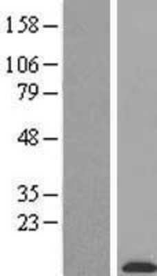 Western Blot: BRICK1 Overexpression Lysate [NBL1-08433]