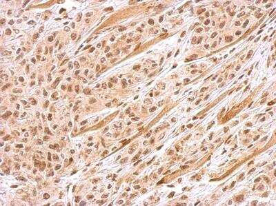 Immunohistochemistry-Paraffin: BRIP1/FANCJ Antibody [NBP1-31883]