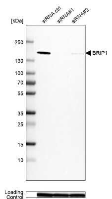 Western Blot: BRIP1/FANCJ Antibody [NBP2-14361]