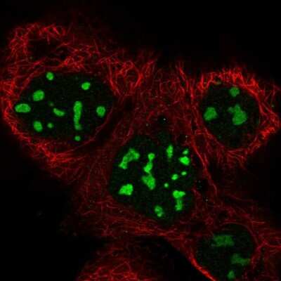 Immunocytochemistry/ Immunofluorescence: BRIX Antibody [NBP1-91708]