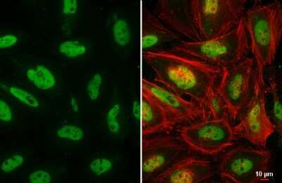 Immunocytochemistry/ Immunofluorescence: BRM Antibody [NBP3-13283]