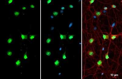 Immunocytochemistry/ Immunofluorescence: BRM Antibody [NBP3-13283]