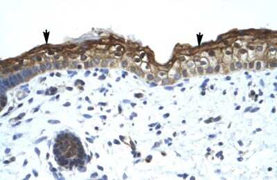Immunohistochemistry-Paraffin: BRM Antibody [NBP1-80042]