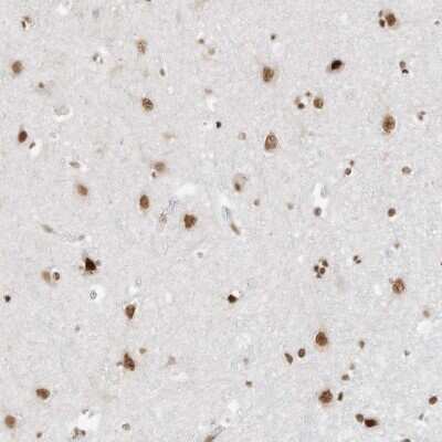 Immunohistochemistry-Paraffin: BRM Antibody [NBP1-90015]