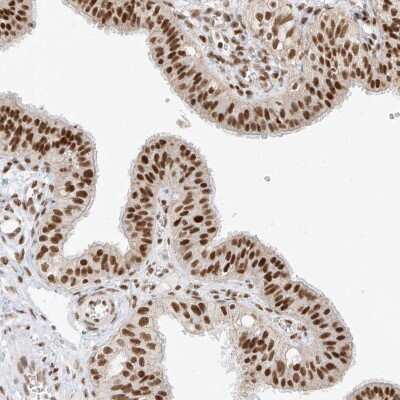 Immunohistochemistry-Paraffin: BRM Antibody [NBP1-90015]
