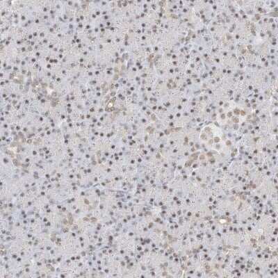 Immunohistochemistry-Paraffin: BRM Antibody [NBP1-90015]