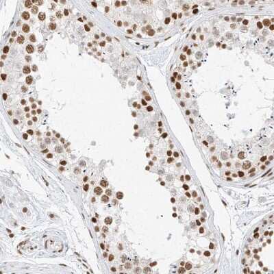 Immunohistochemistry-Paraffin: BRM Antibody [NBP1-90015]