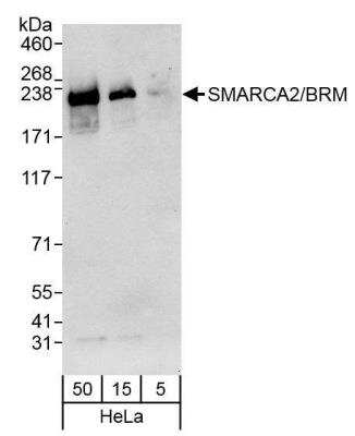 QcWestern: BRM Antibody [NB100-55309]