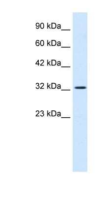 Western Blot: BRM Antibody [NBP1-80042]
