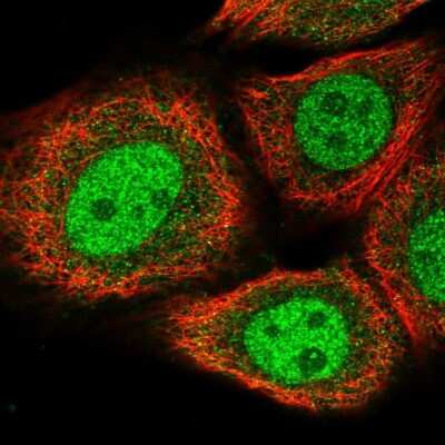 Immunocytochemistry/ Immunofluorescence: BRMS1L Antibody [NBP2-14362]